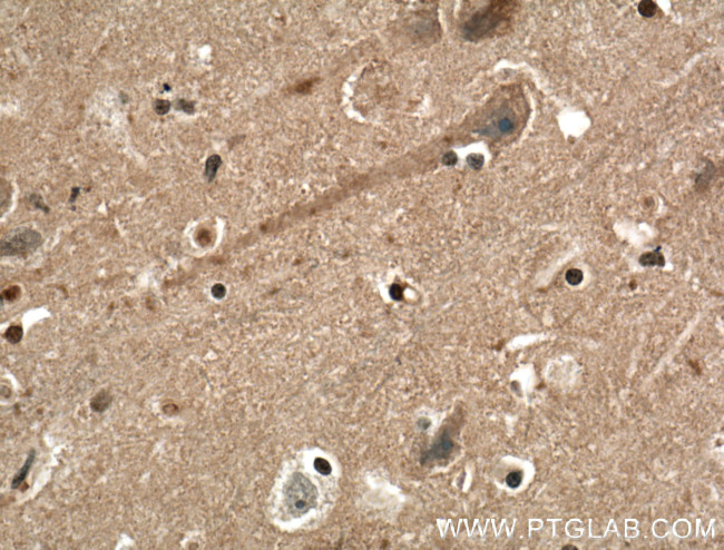 EPB41L3 Antibody in Immunohistochemistry (Paraffin) (IHC (P))