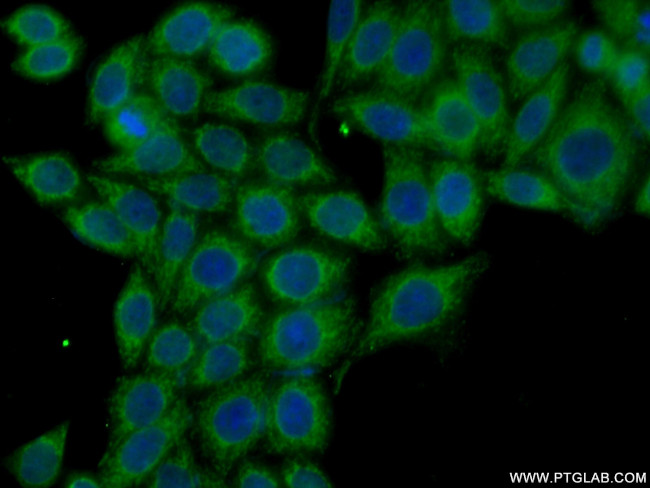 NRAS Antibody in Immunocytochemistry (ICC/IF)