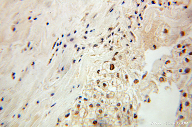 PDCD2 Antibody in Immunohistochemistry (Paraffin) (IHC (P))