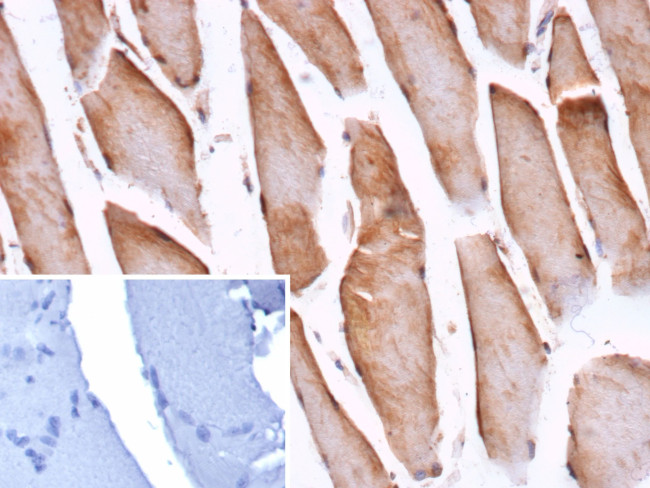 CFL2/NEM7 Antibody in Immunohistochemistry (Paraffin) (IHC (P))