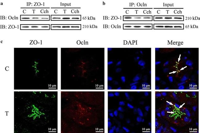 Occludin Antibody in Immunohistochemistry, Immunoprecipitation (IHC, IP)