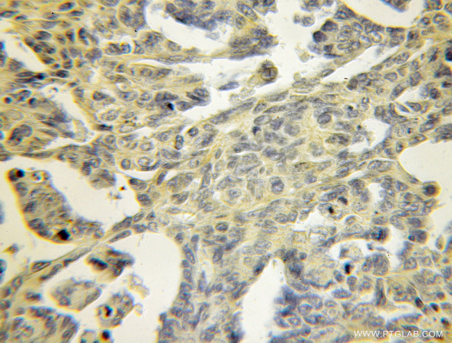 TPM3 Antibody in Immunohistochemistry (Paraffin) (IHC (P))