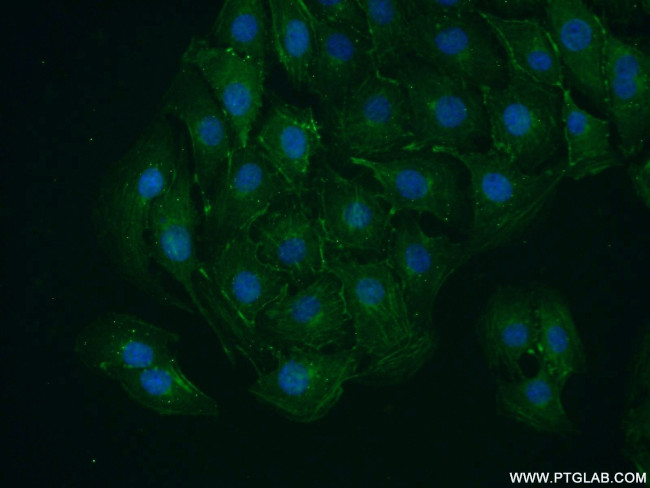 VAMP4 Antibody in Immunocytochemistry (ICC/IF)