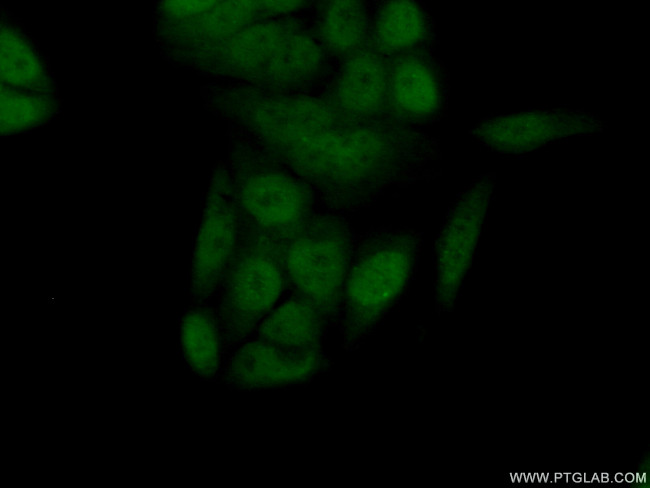 Centromere protein R Antibody in Immunocytochemistry (ICC/IF)