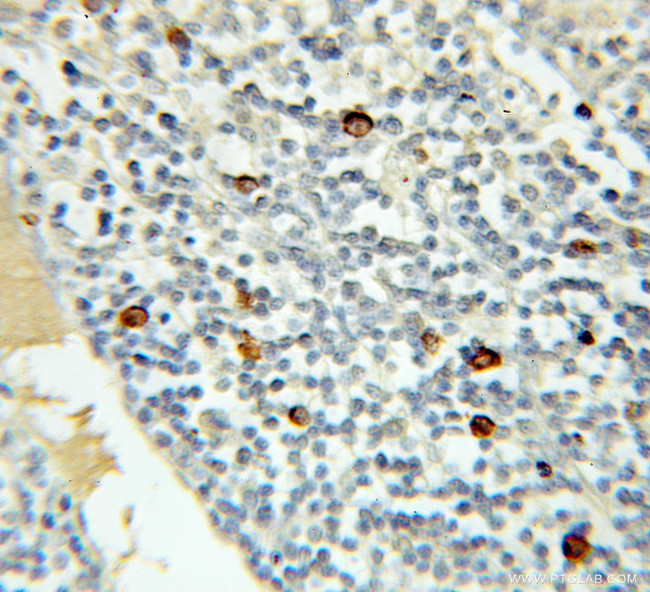 MRE11 Antibody in Immunohistochemistry (Paraffin) (IHC (P))