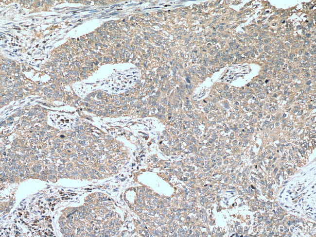 LKB1 Antibody in Immunohistochemistry (Paraffin) (IHC (P))