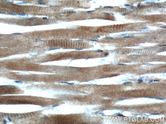 UCP3 Antibody in Immunohistochemistry (Paraffin) (IHC (P))