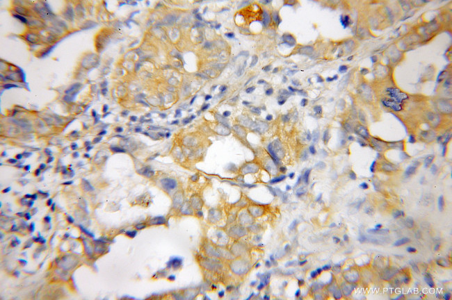 PTGDS Antibody in Immunohistochemistry (Paraffin) (IHC (P))