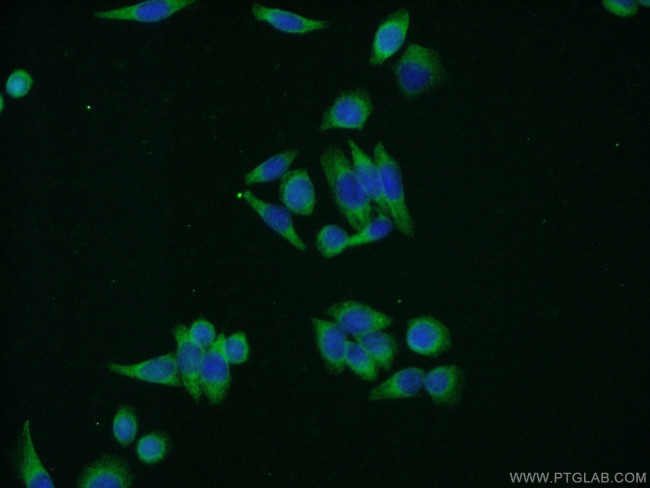 SND1 Antibody in Immunocytochemistry (ICC/IF)