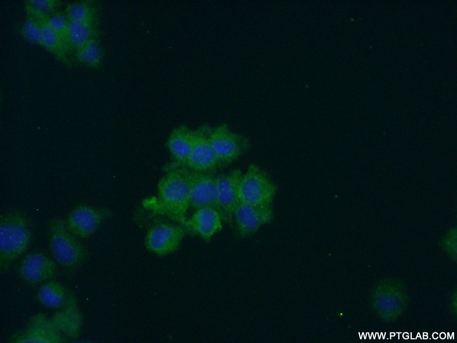 Secretogranin V Antibody in Immunocytochemistry (ICC/IF)