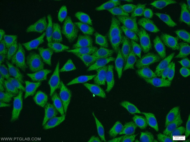 HPS3 Antibody in Immunocytochemistry (ICC/IF)