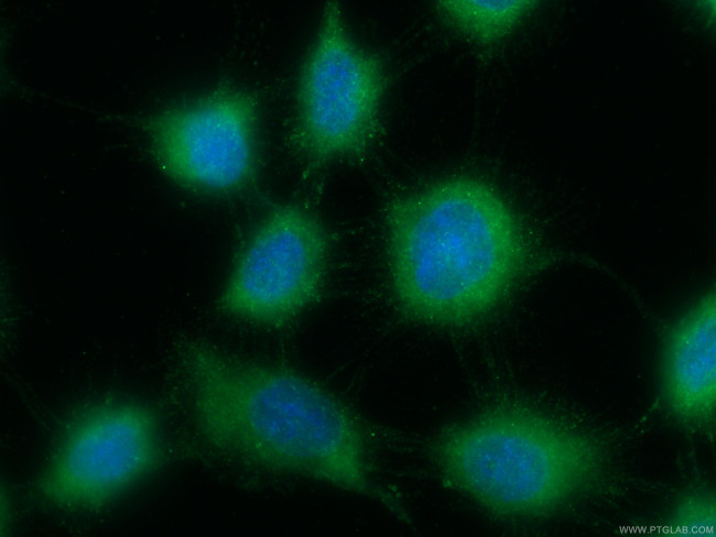 ACOT11 Antibody in Immunocytochemistry (ICC/IF)