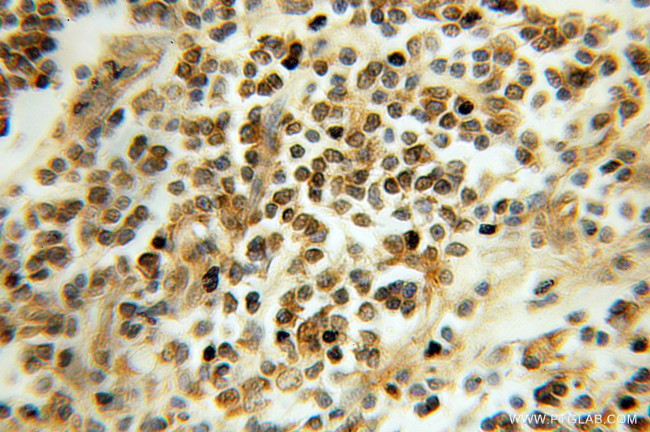 TCEB2 Antibody in Immunohistochemistry (Paraffin) (IHC (P))