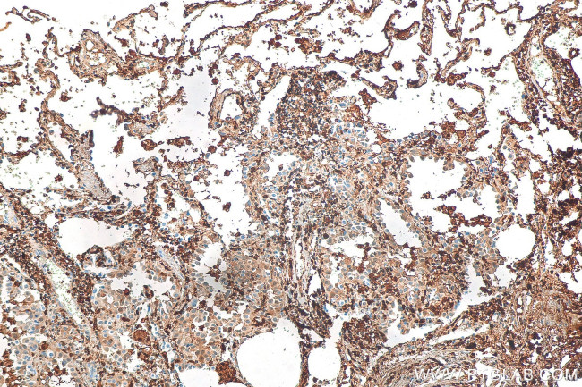 COTL1 Antibody in Immunohistochemistry (Paraffin) (IHC (P))