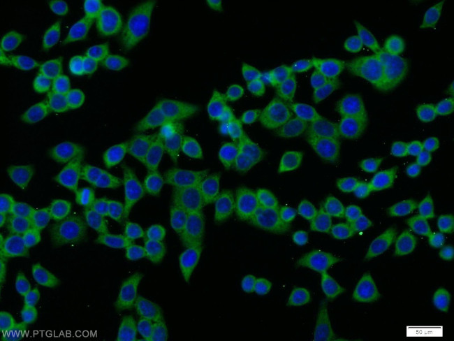 TRIP10 Antibody in Immunocytochemistry (ICC/IF)