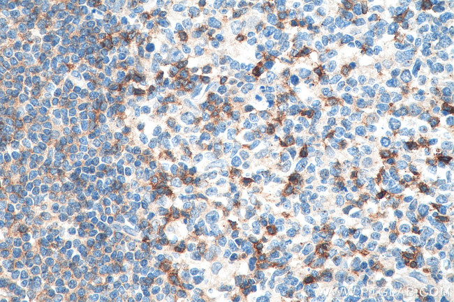 CD69 Antibody in Immunohistochemistry (Paraffin) (IHC (P))