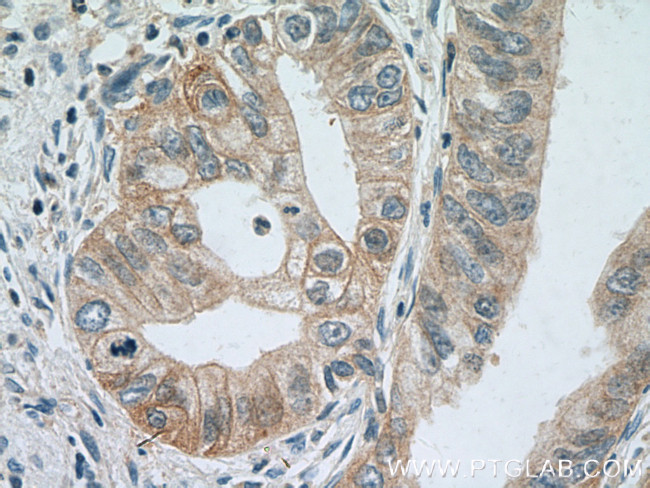 IFNGR1 Antibody in Immunohistochemistry (Paraffin) (IHC (P))