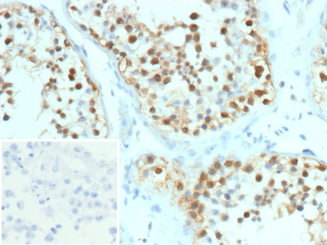 Heat Shock Protein 105 kDa/HSP105 (Basaloid Skin Tumor Marker) Antibody in Immunohistochemistry (Paraffin) (IHC (P))