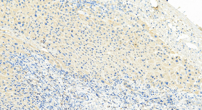 CXCL5 Antibody in Immunohistochemistry (Paraffin) (IHC (P))