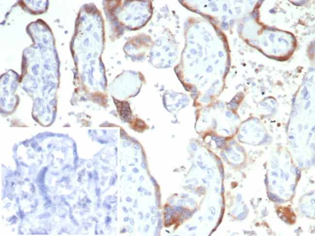 HCG-beta (Pregnancy and Choriocarcinoma Marker) Antibody in Immunohistochemistry (Paraffin) (IHC (P))