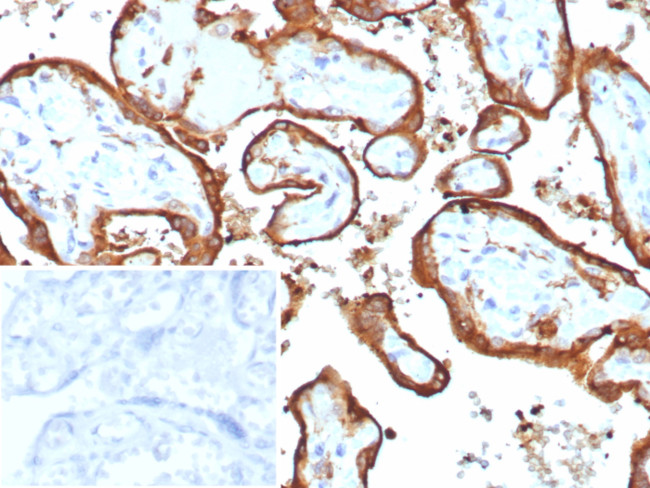 HCG-beta (Pregnancy and Choriocarcinoma Marker) Antibody in Immunohistochemistry (Paraffin) (IHC (P))