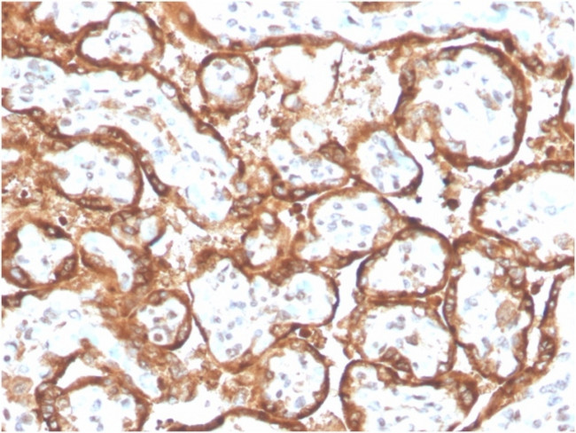 HCG-beta Antibody in Immunohistochemistry (Paraffin) (IHC (P))