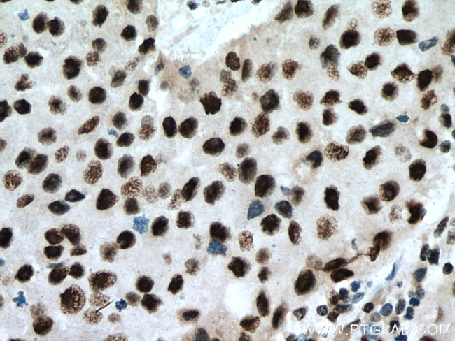 PUF60 Antibody in Immunohistochemistry (Paraffin) (IHC (P))