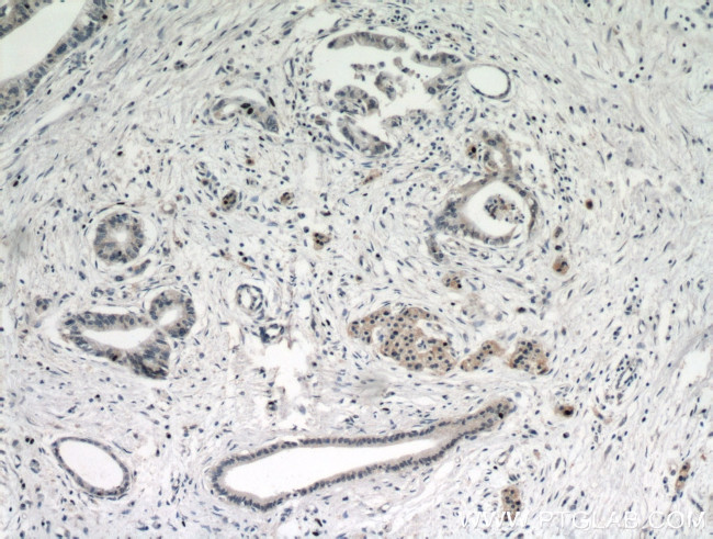 ARHI Antibody in Immunohistochemistry (Paraffin) (IHC (P))