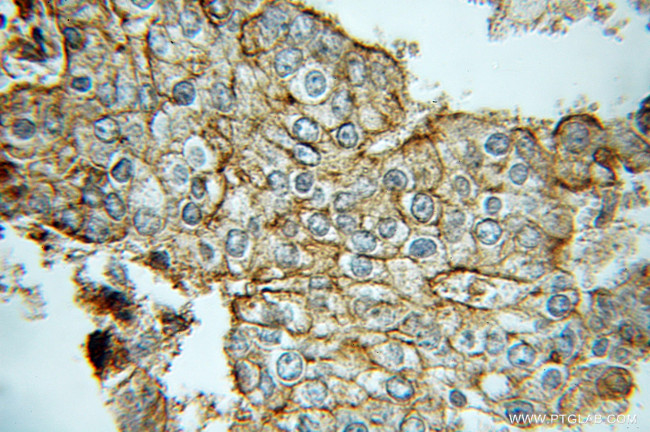 Kallikrein 2 Antibody in Immunohistochemistry (Paraffin) (IHC (P))