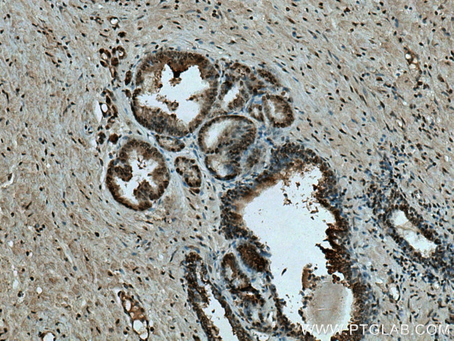 SMARCE1 Antibody in Immunohistochemistry (Paraffin) (IHC (P))