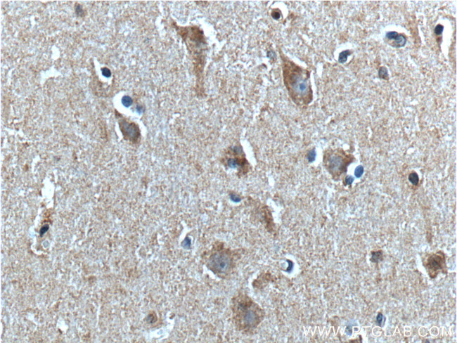 PTHLH Antibody in Immunohistochemistry (Paraffin) (IHC (P))