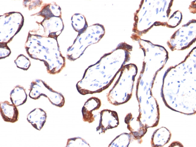 HCG-beta (Pregnancy and Choriocarcinoma Marker) Antibody in Immunohistochemistry (Paraffin) (IHC (P))