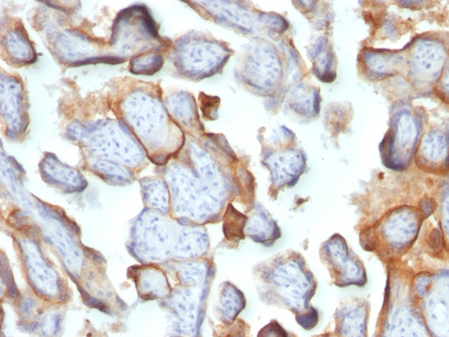 HCG-beta (Pregnancy and Choriocarcinoma Marker) Antibody in Immunohistochemistry (Paraffin) (IHC (P))