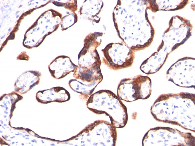 HCG-beta Antibody in Immunohistochemistry (Paraffin) (IHC (P))