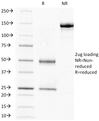 HCG-beta (Pregnancy and Choriocarcinoma Marker) Antibody in SDS-PAGE (SDS-PAGE)