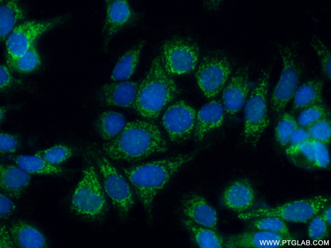 IVD Antibody in Immunocytochemistry (ICC/IF)