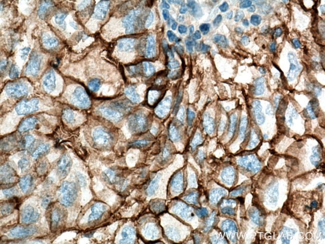 ICAM-1 Antibody in Immunohistochemistry (Paraffin) (IHC (P))
