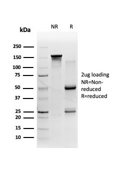 FTCD/58K Golgi Protein Antibody in SDS-PAGE (SDS-PAGE)