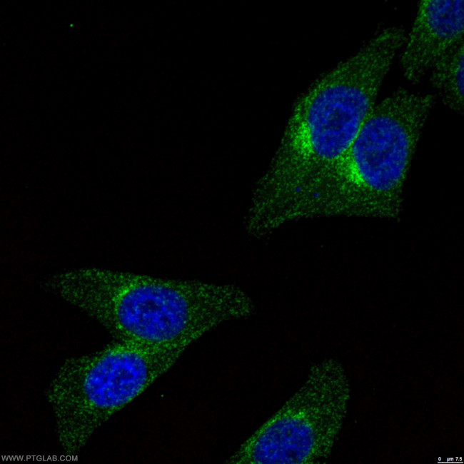 CLTA Antibody in Immunocytochemistry (ICC/IF)