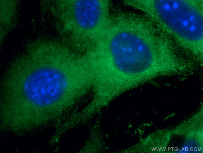 BLNK Antibody in Immunocytochemistry (ICC/IF)