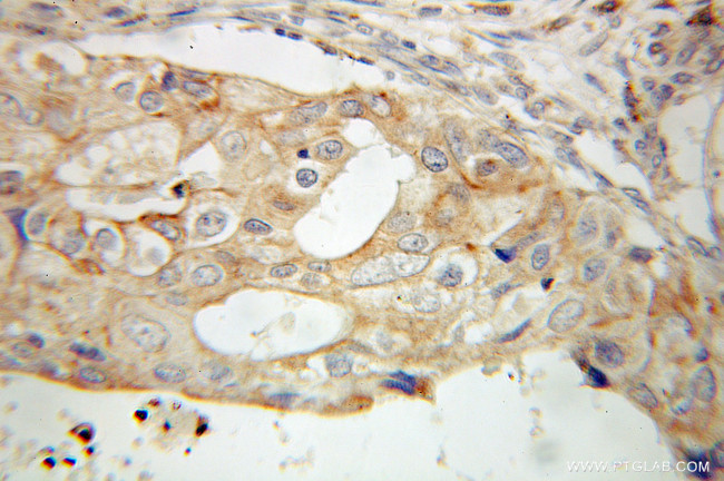 PCDHGC3 Antibody in Immunohistochemistry (Paraffin) (IHC (P))