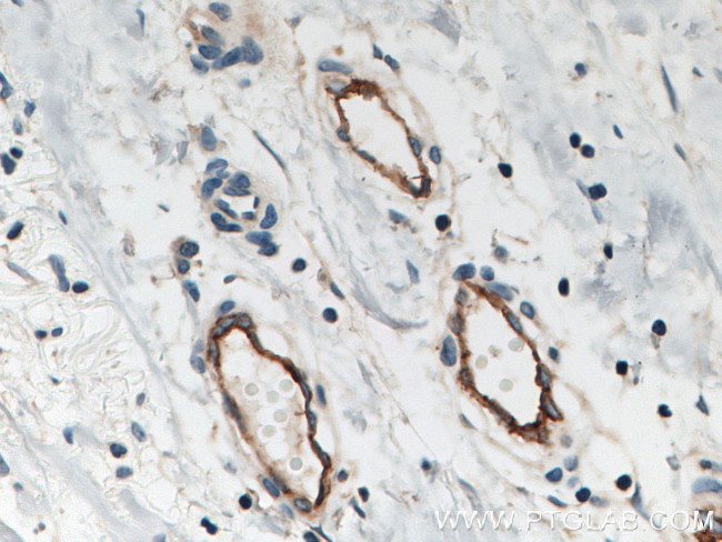 Endoglin/CD105 Antibody in Immunohistochemistry (Paraffin) (IHC (P))