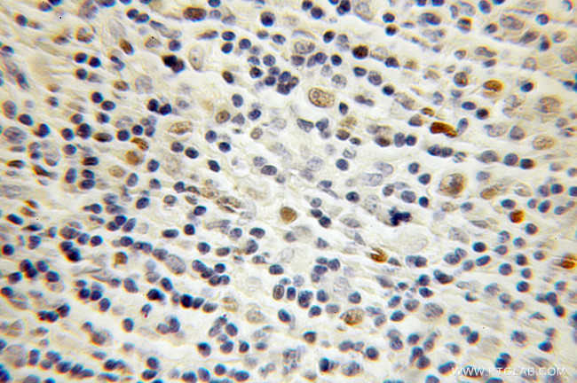 OCT2 Antibody in Immunohistochemistry (Paraffin) (IHC (P))