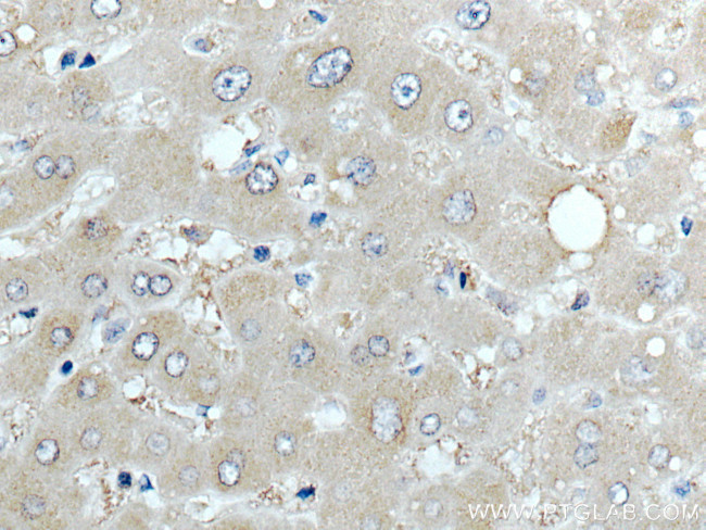 ARMET Antibody in Immunohistochemistry (Paraffin) (IHC (P))