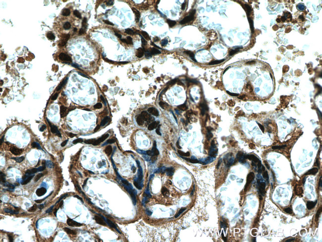 FBXO5 Antibody in Immunohistochemistry (Paraffin) (IHC (P))