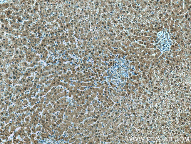 GAMT Antibody in Immunohistochemistry (Paraffin) (IHC (P))