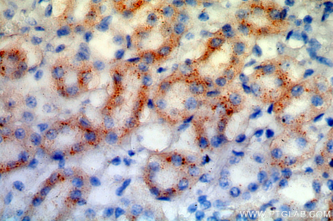 PPT1 Antibody in Immunohistochemistry (Paraffin) (IHC (P))
