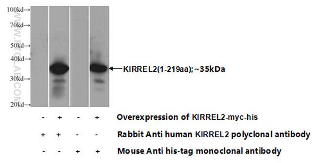 KIRREL2 Antibody in Western Blot (WB)