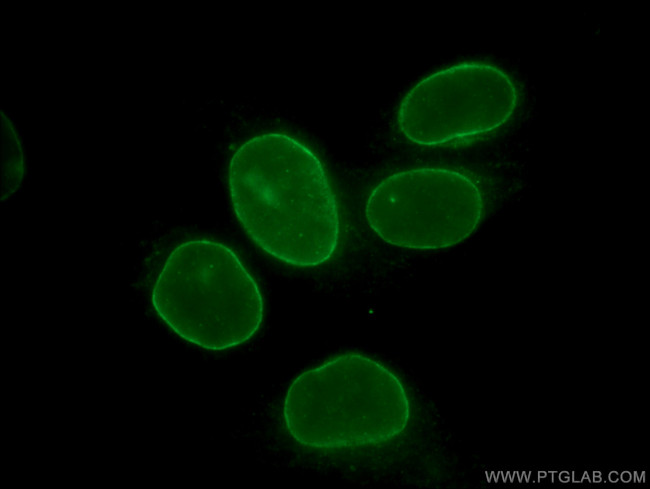 LMNB2 Antibody in Immunocytochemistry (ICC/IF)