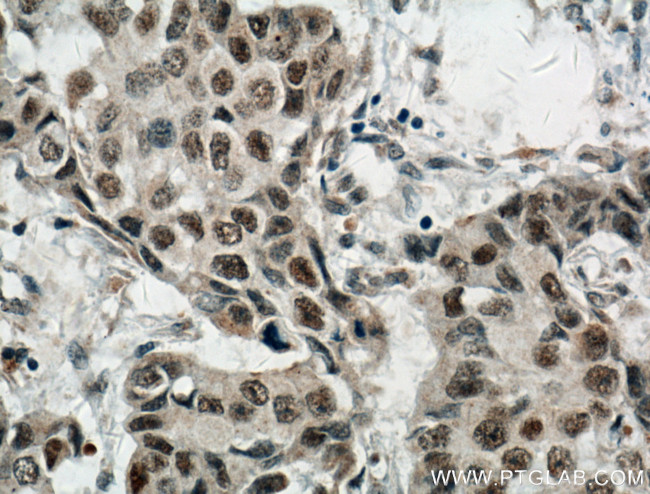 Cyclin G Antibody in Immunohistochemistry (Paraffin) (IHC (P))